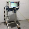 Ventilator
